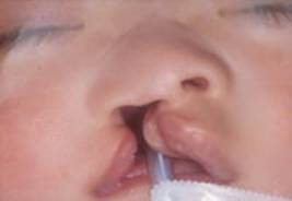 ��¦��������