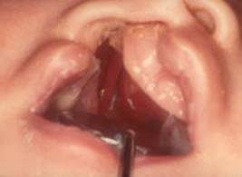 ��¦��������������