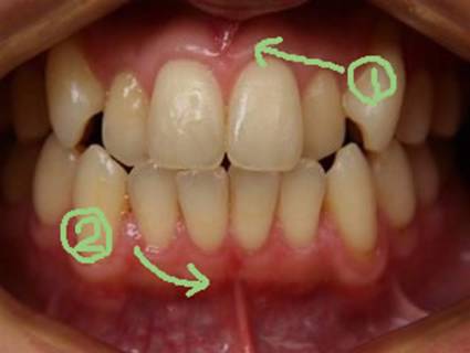 �忰���ӡ���������