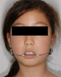 ���ɤ�ζ��� �إåɥ�����01