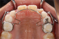 ���ɤ�ζ��� SLA01