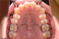 ���ɤ�ζ��� �ѥ饿��С�01