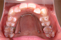 ���ɤ�ζ��� QH01