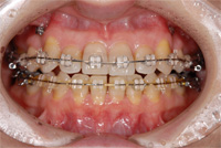 ���ɤ�ζ��� �ޥ���֥饱�å�����01