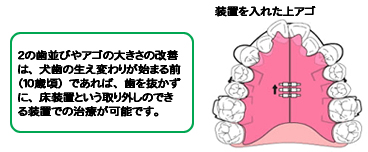 ���ɤ�ζ��� ���֤����줿�奢��