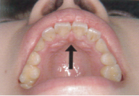 ���ɤ�ζ��� �������������01