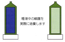 �ñ���κٶݤ����ܤ�����